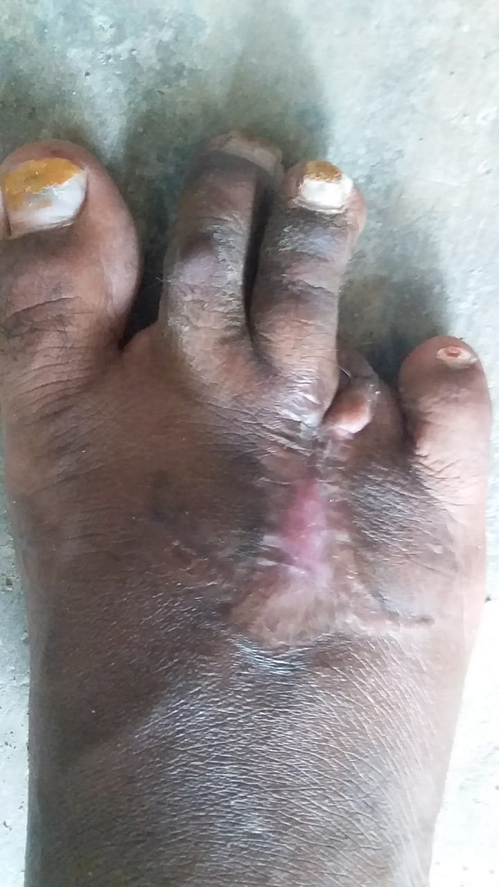 Day 1